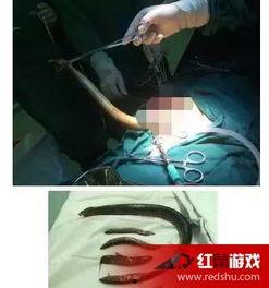 女主播黄鳝视频连接,揭秘网络直播的黑暗面